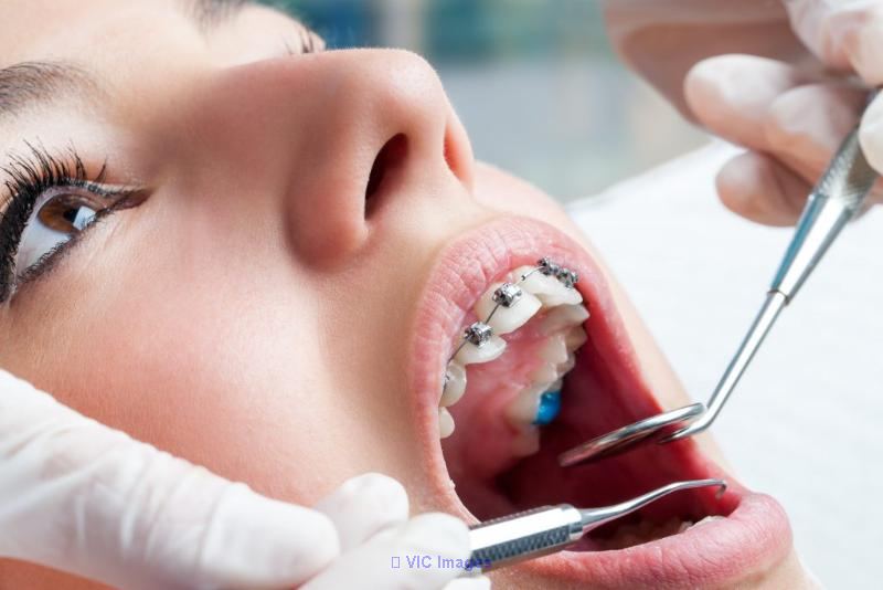 Invisalign Winnipeg - Tuxedo Dental Group