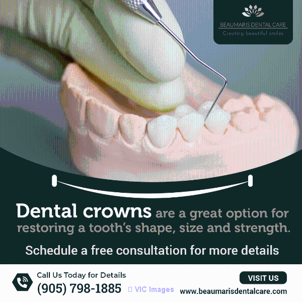 Dental Crowns Brampton