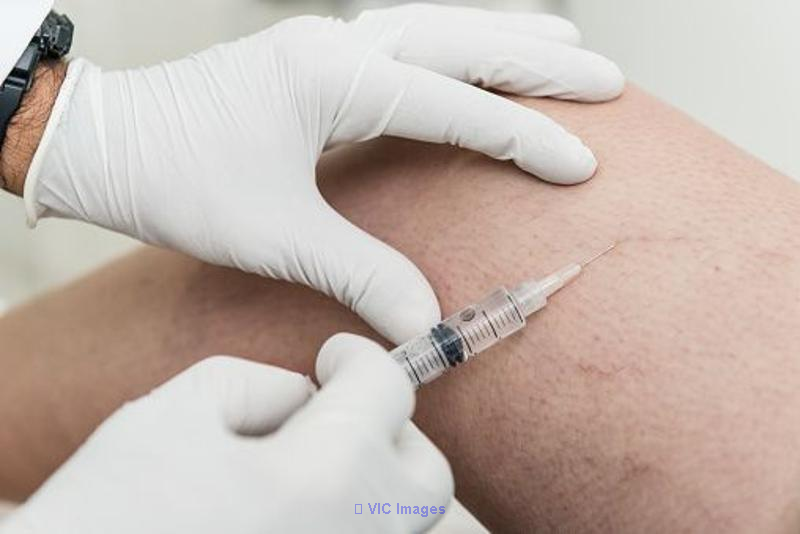 Be Vein-Free and Radiant: Customized Solutions for Varicose and Spider