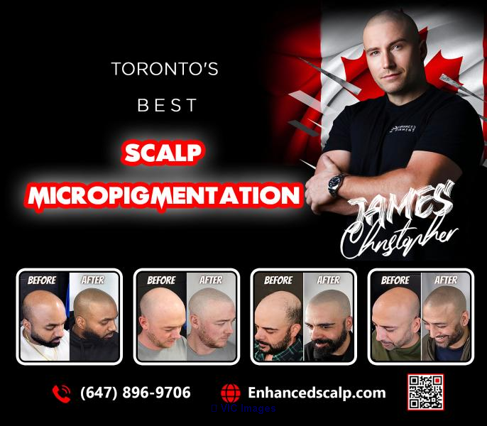 Enhanced Scalp services