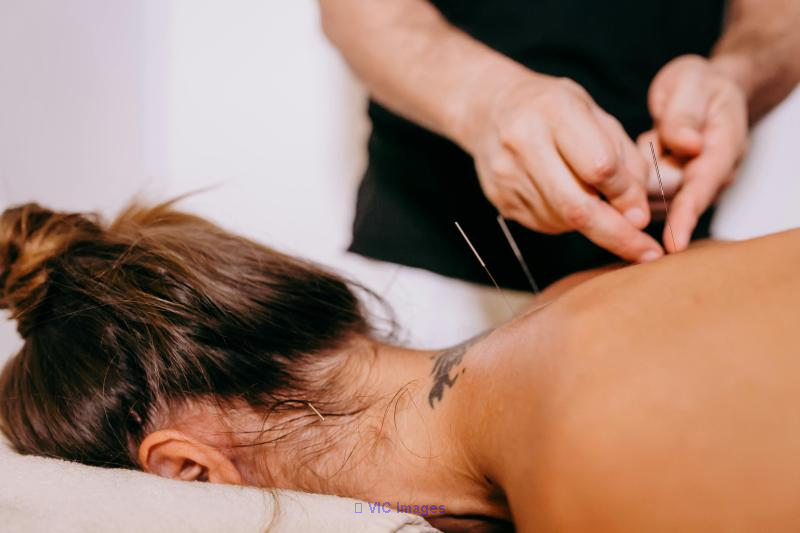 Discover Wellness at Toronto's Premier Acupuncture Clinic!