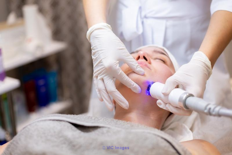 The Ultimate Guide to Understanding Acne Laser Treatment: How Does It