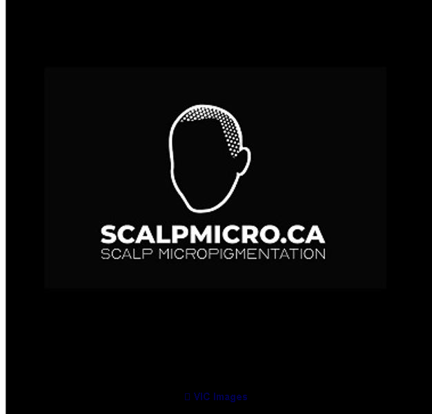 SCALPMICRO Scalp Micropigmentation Calgary